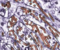 Dozens are sick in E. coli outbreak linked to carrots. Here’s what to know about symptoms and how it spreads